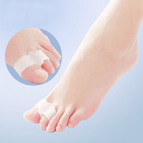 Bunion corrector