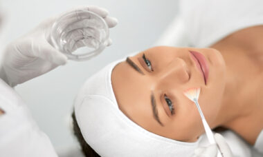 Benefits of Chemical Peels - Transforming Your Skin from Dull to Radiant
