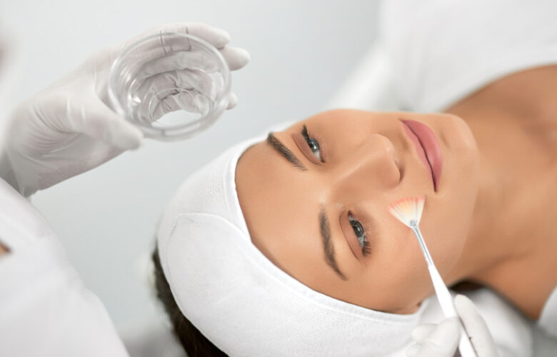 Benefits of Chemical Peels - Transforming Your Skin from Dull to Radiant