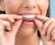What To Know Before Starting Invisalign Treatment